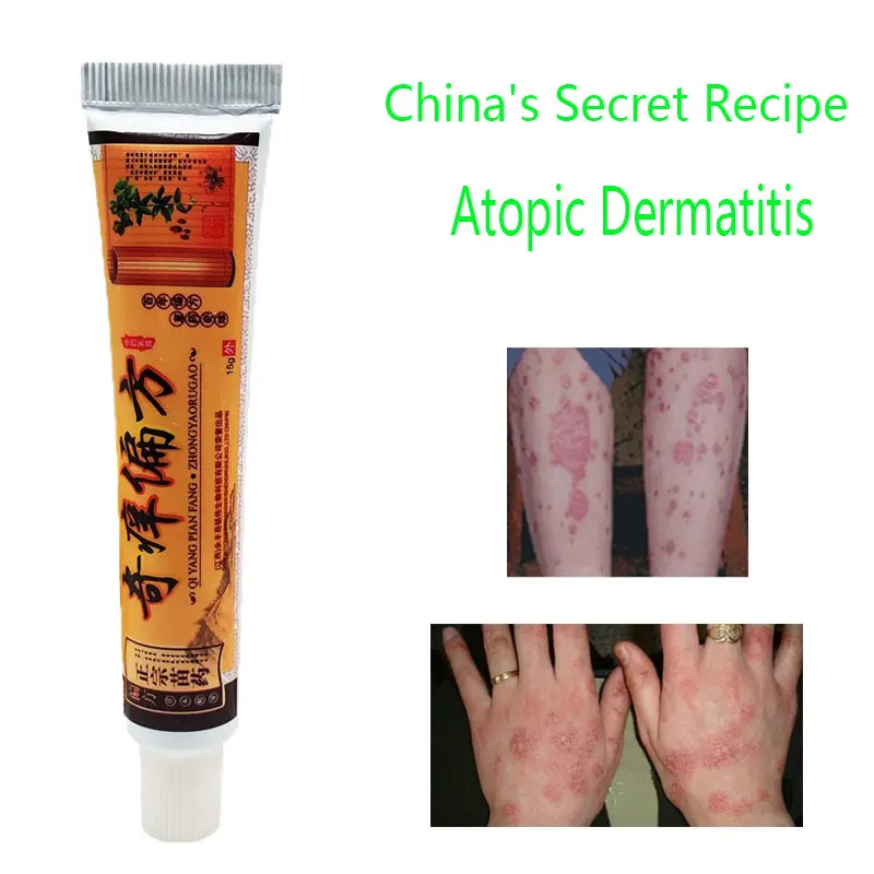 Dermatiit Anti seeninfektsiooni Dermatiit Koor Psoriaas, Ekseem Koor Atoopiline Dermatiit Anti-itch 2